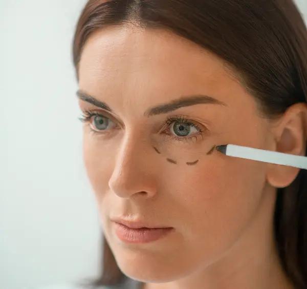 Operace očních víček